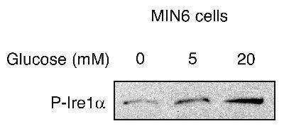 Western Blot Detection of IRE1 alpha in Glucose Treated Min6 Cells